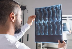 doctor analyzing spinal cord injury x-ray