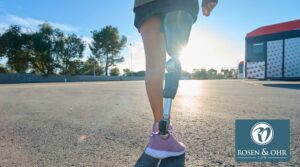 Woman with prosthetic leg walking outdoors